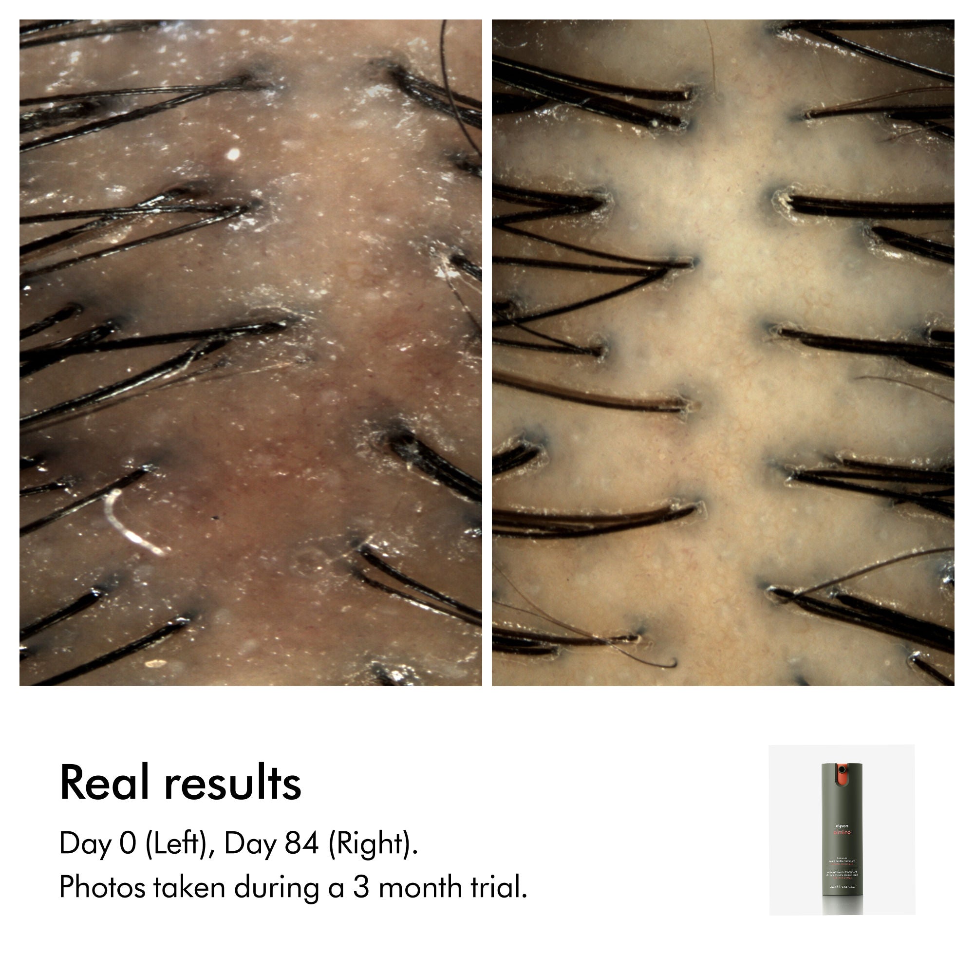 Amino Balance & Strengthen Scalp Treatment for Fuller Looking Hair