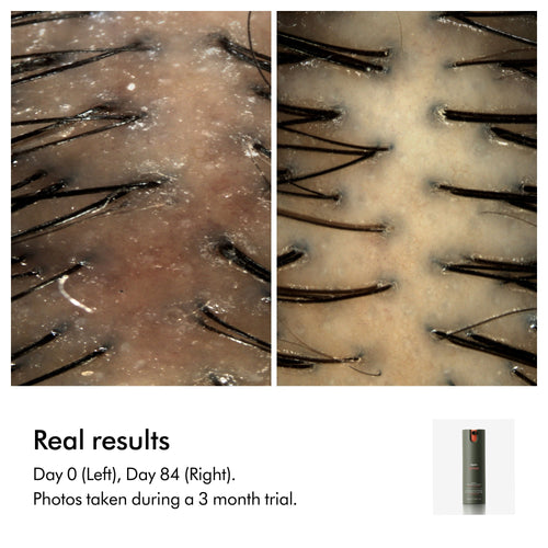 Amino Balance & Strengthen Scalp Treatment for Fuller Looking Hair