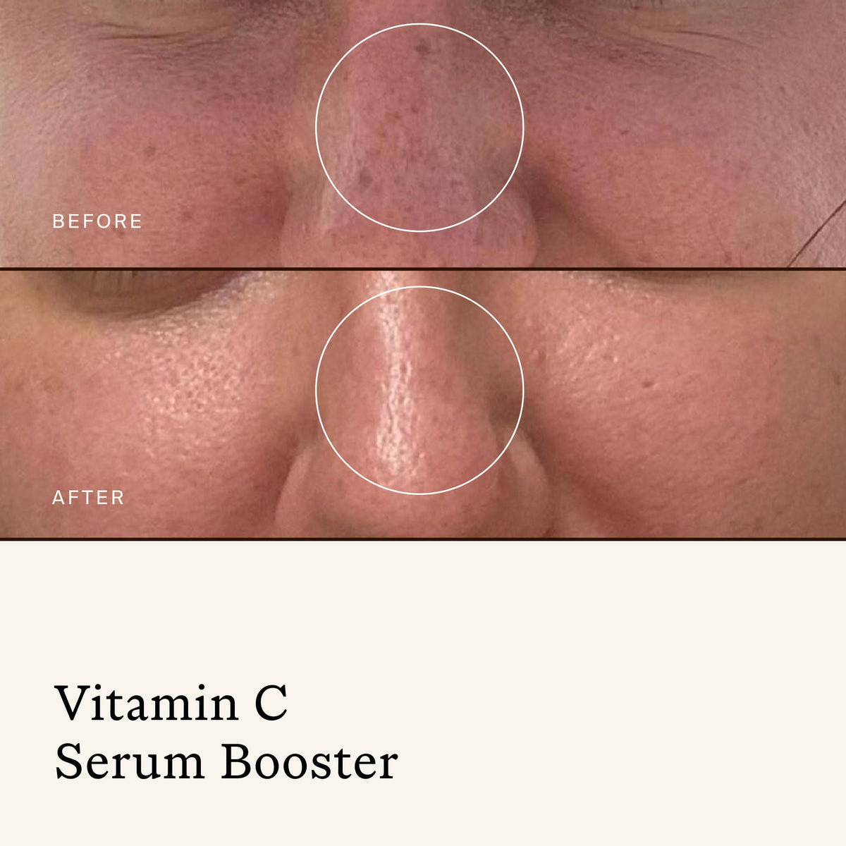 Vitamin C Serum Booster